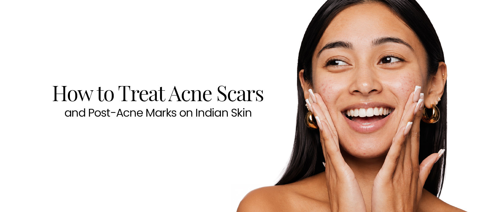 How to Treat Acne Scars and Post-Acne Marks on Indian Skin