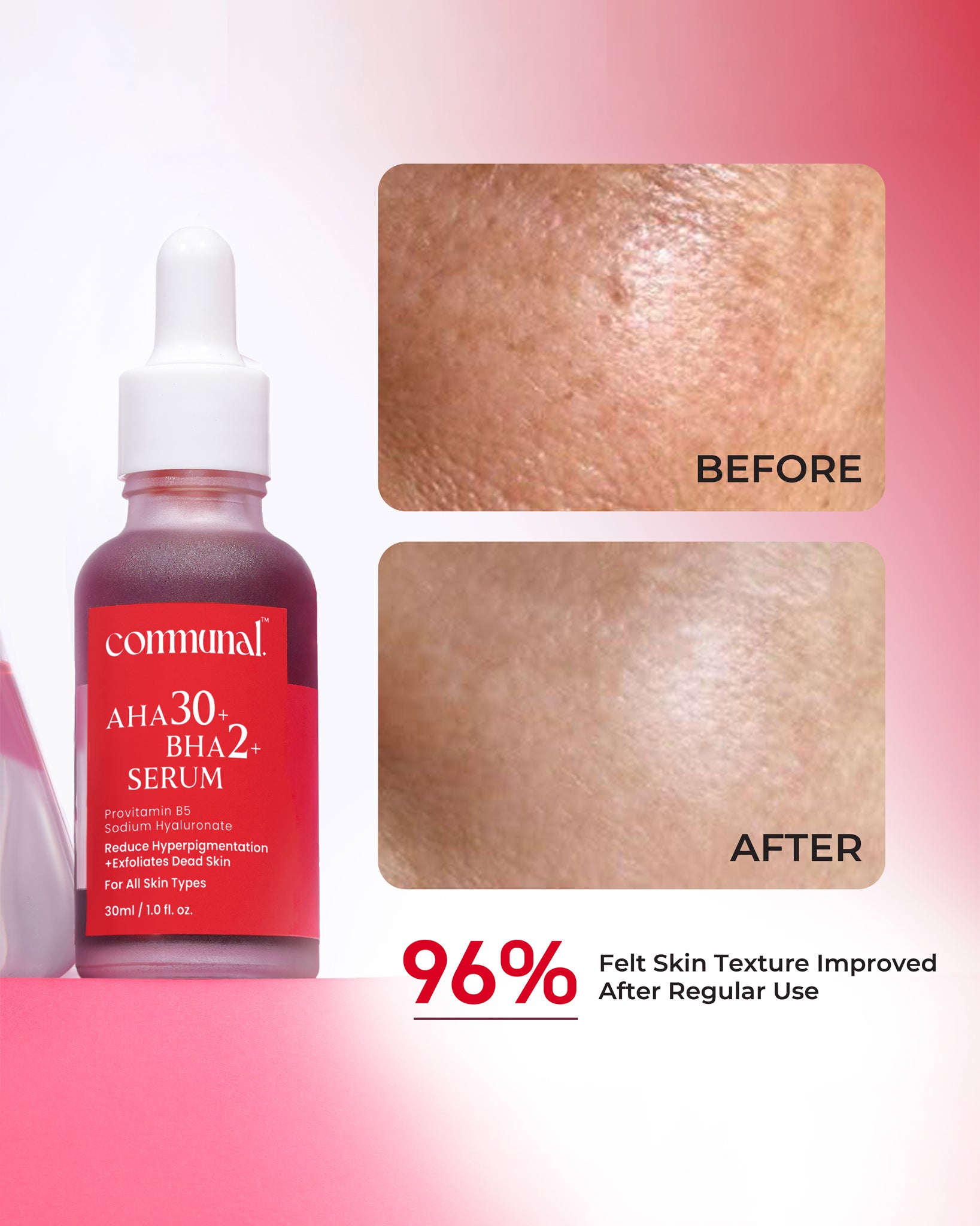 30% AHA + 2% BHA Face Serum