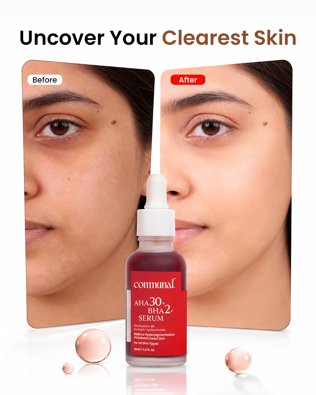 30% AHA + 2% BHA Face Serum
