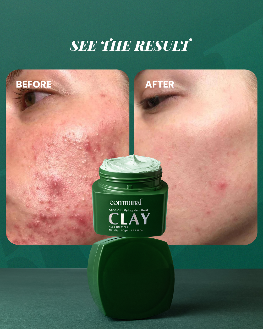 Acne Clarifying Heartleaf Clay Mask