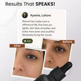 Retinol Face Serum