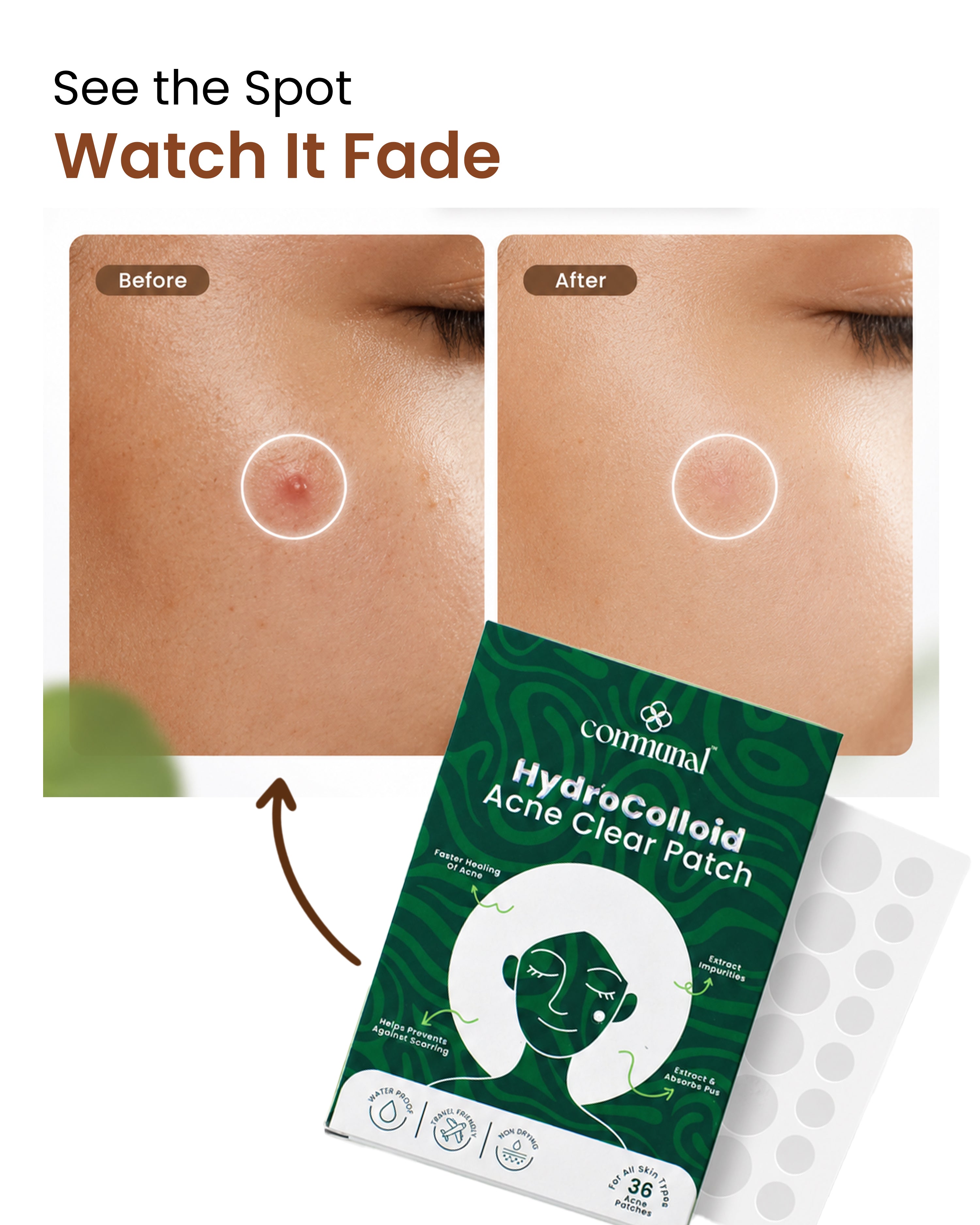 HydroColloid Acne Clear Patch