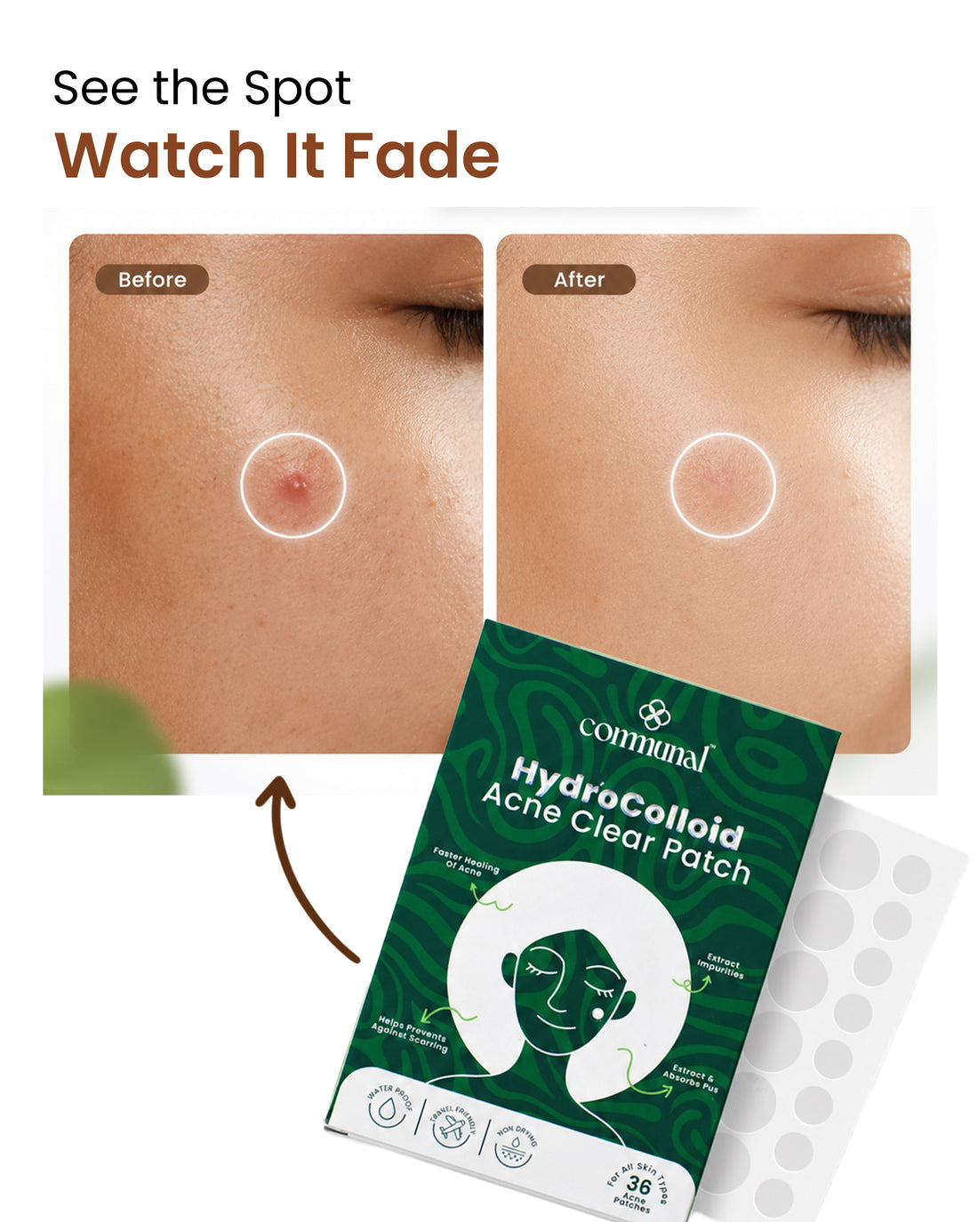 HydroColloid Acne Clear Patch