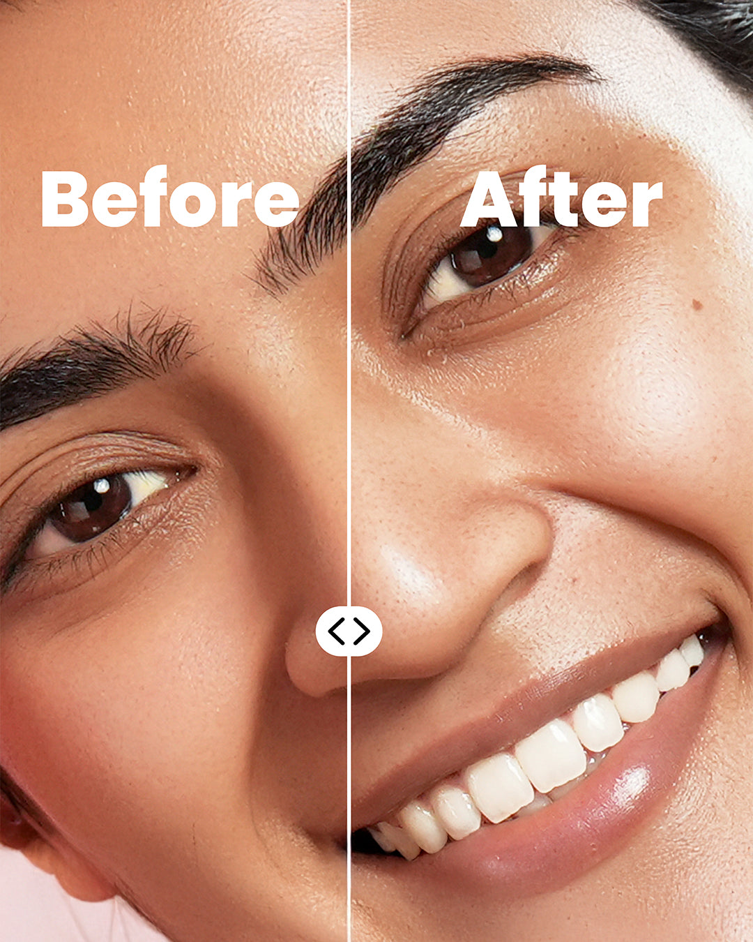 Barrier Repair Ceramide Moisturiser